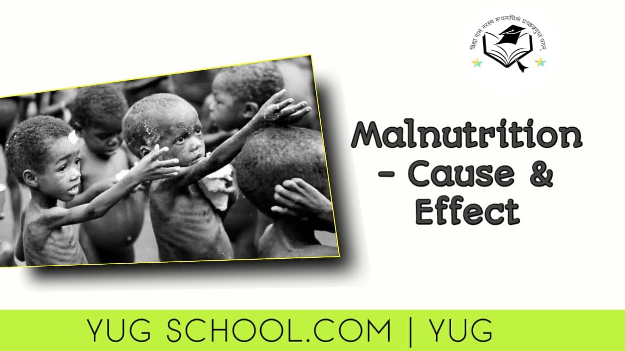 Cause and Effect of Malnutrition
